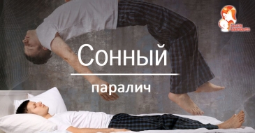 Сонный паралич, или ступор