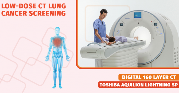 Low-dose lung cancer screening 