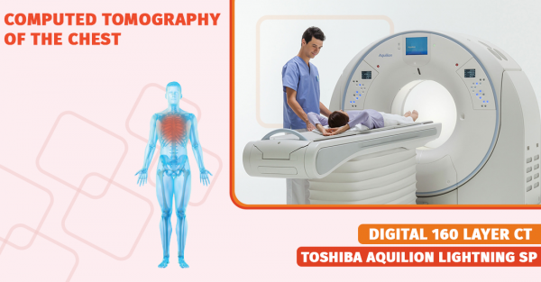 chest computed tomography