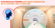 3 Tesla MRI of the brain with contrast and hyperprolactinemia