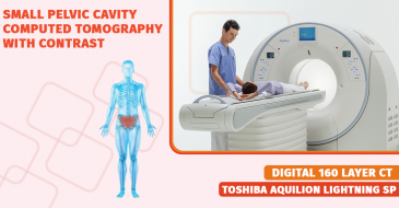 CT study of the small pelvis with contrast