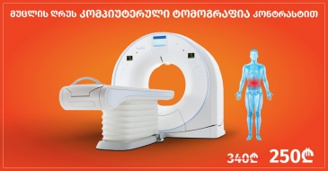 მუცლის ღრუს კომპიუტერული ტომოგრაფია კონტრასტით