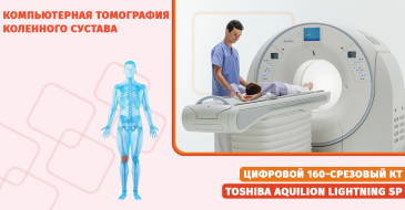  Компьютерная томография коленного сустава