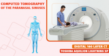 Computed tomography of the paranasal sinuses