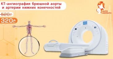 КТ-ангиография брюшной аорты и артерии нижних конечностей