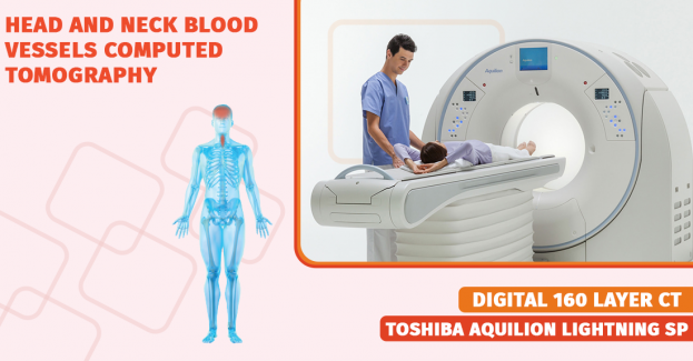 Research of blood vessels of the head and neck (carotid) with angio-mode