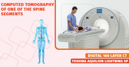 Computed tomography of the spine segment