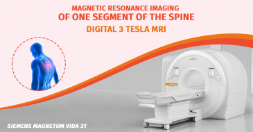 Single segment (MRI) of the spine