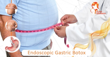 Losing excess weight with Gastric Botox is already available in Georgia and the method was established in the clinic “New Life”