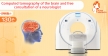 Brain CT scan and consultation with a neurologist