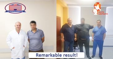 Stomach operation for weight loss – Man who lost 100 kg in 11 months with sleeve-gastrectomy