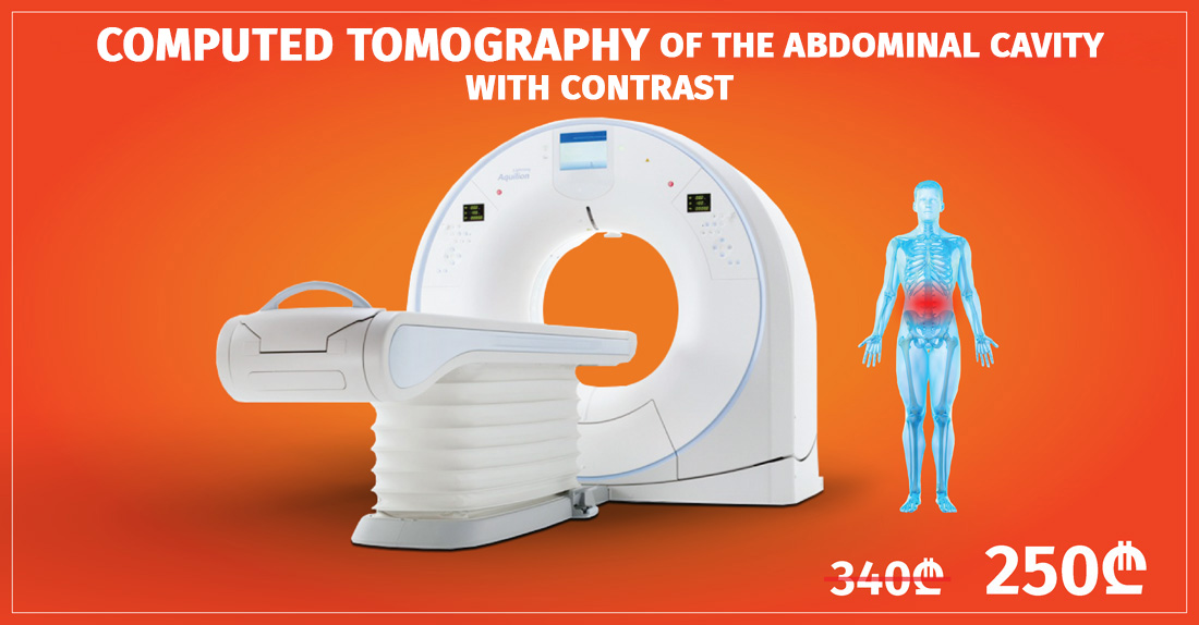 Abdominal Computed Tomography With Contrast