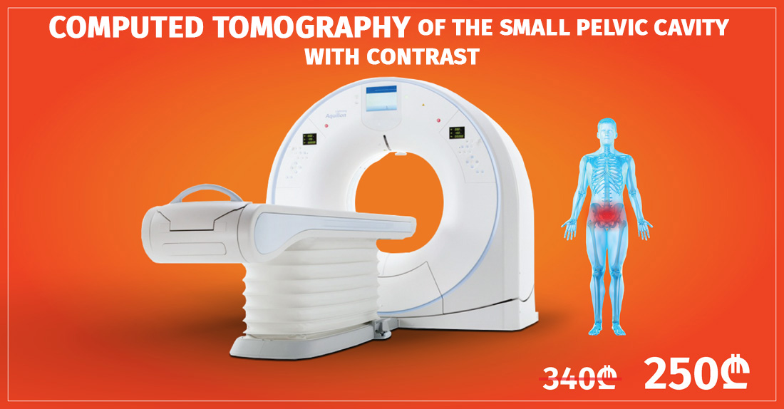 CT Study Of The Small Pelvic Cavity With Contrast