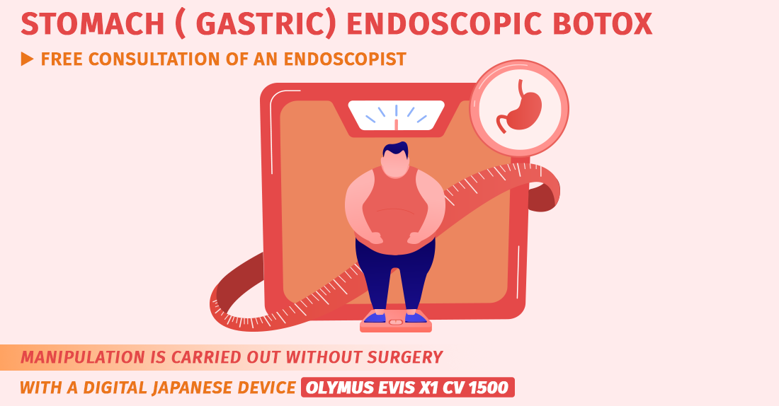 Gastric Endoscopic-Botox Injection With Discount