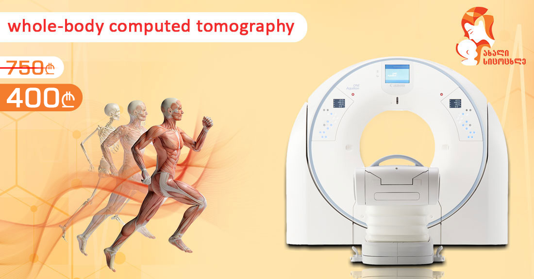 CT of the Whole-body