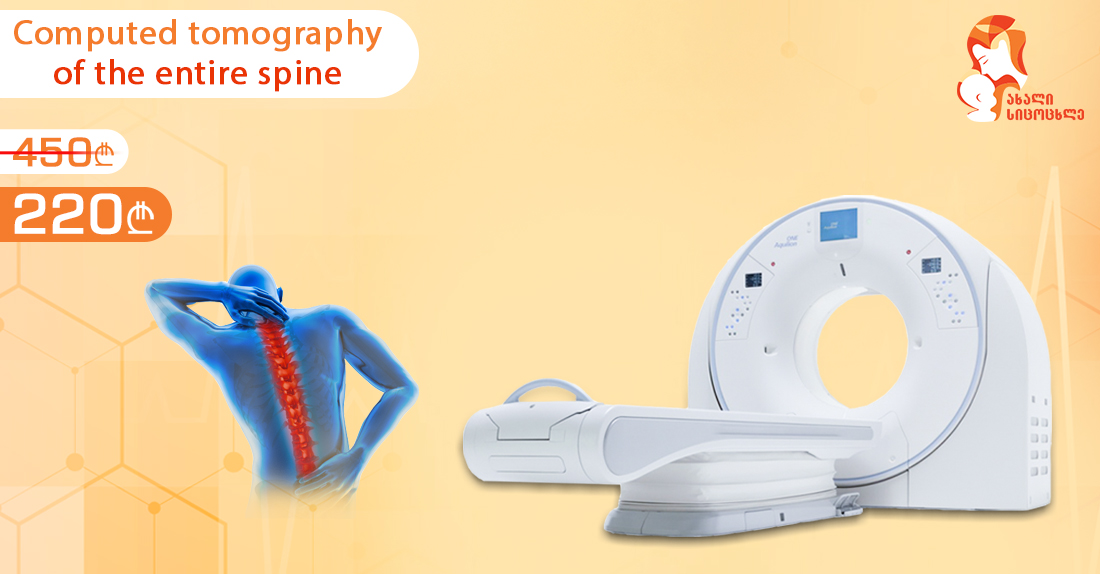 Computed Tomography Of The Vertebrae