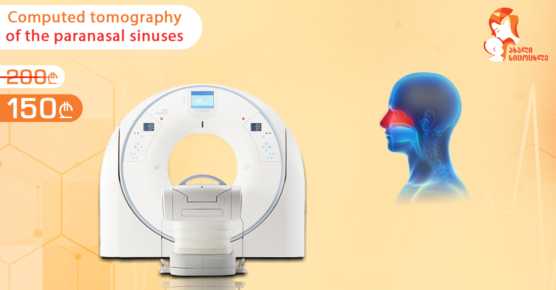 Computed Tomography Of The Paranasal Sinuses