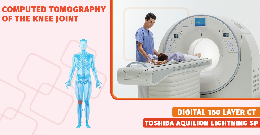 Computed tomography of the knee joint