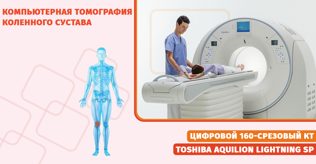  Компьютерная томография коленного сустава