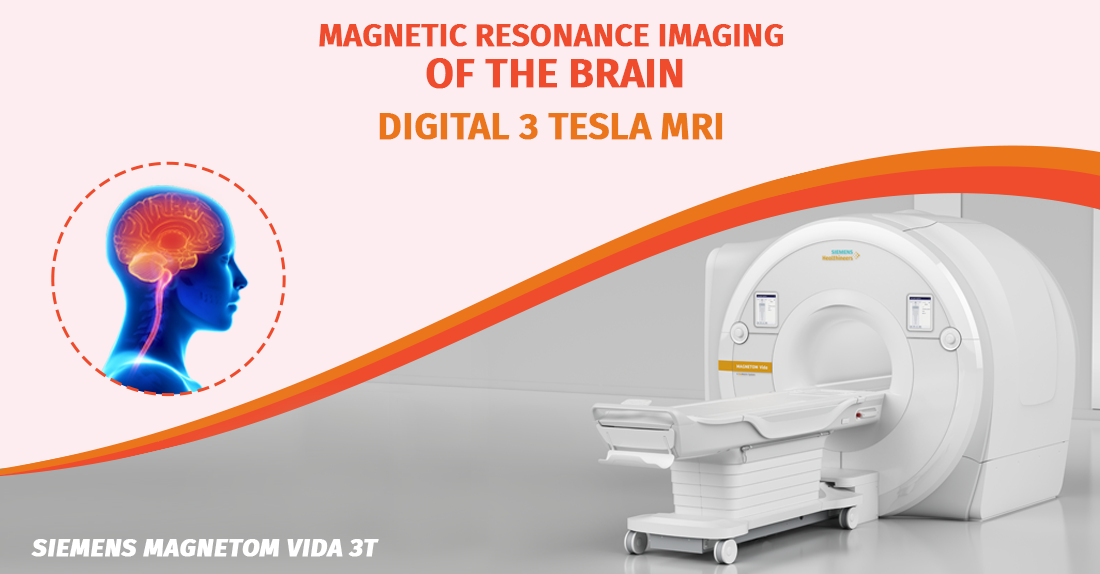 Magnetic – Resonance Tomography of the brain